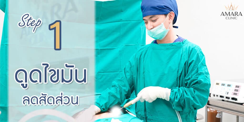 ดูดไขมันลดสัดส่วน ดูดไขมันหน้าท้อง