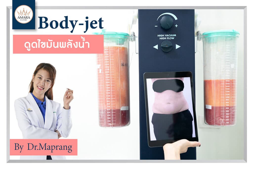 รีวิวดูดไขมัน