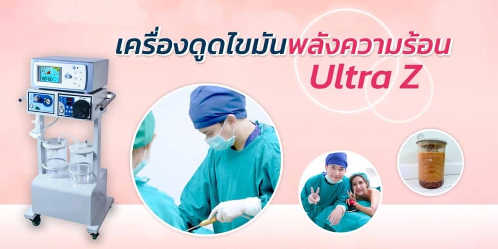 ดูดไขมันพลังความร้อน
