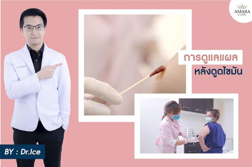 ดูดไขมัน