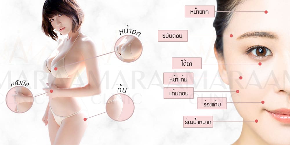 Fat Grafting เติมเต็มไขมัน แก้จุดบกพร่อง