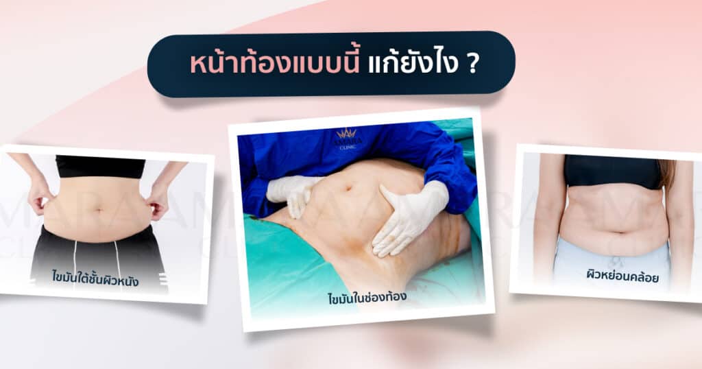 หน้าท้องแต่ละแบบ