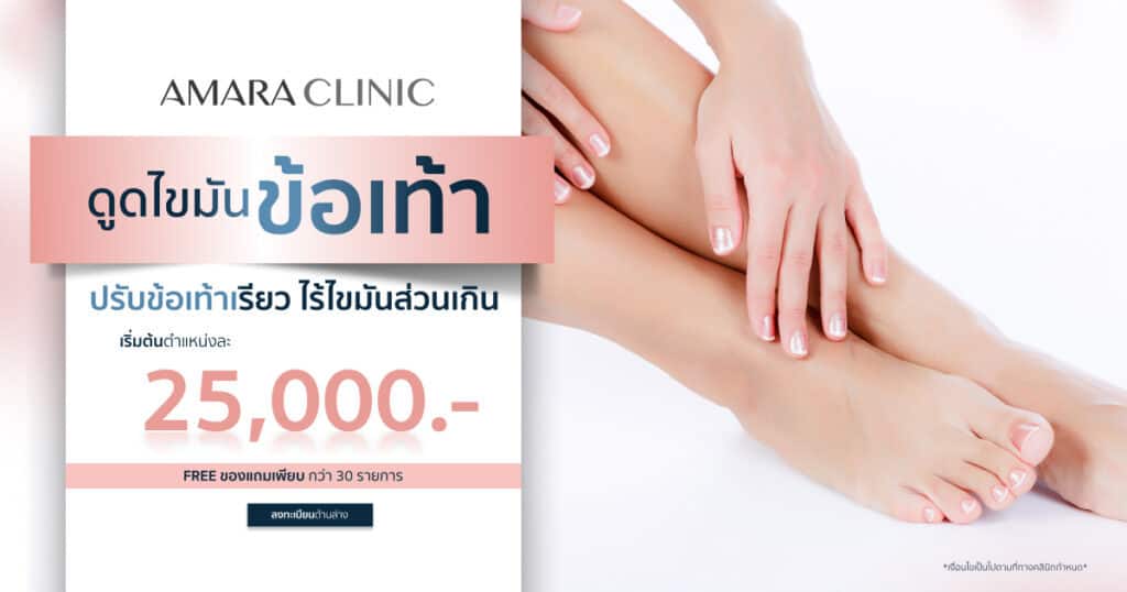 ดูดไขมันข้อเท้า