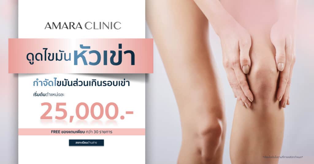 ดูดไขมันหัวเข่า