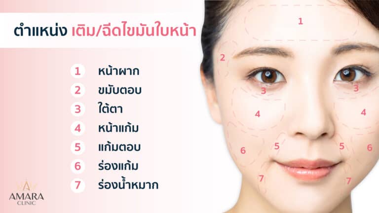 หน้าหย่อนคล้อย