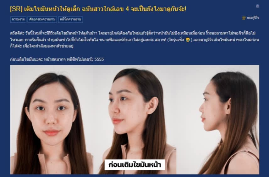 เติมไขมันหน้า Pantip